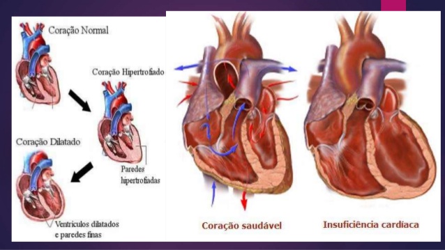 Coenzima Q10 (CoQ10) - ¡protector cardiológico!
